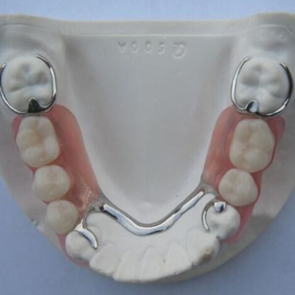Galeri Aiman Dental (10)