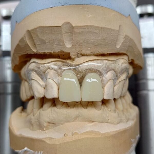 Galeri Aiman Dental (5)