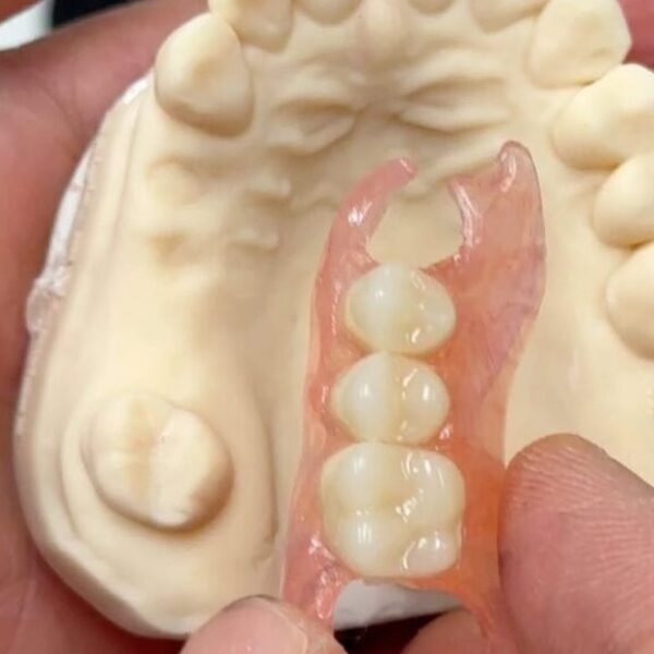 Galeri Aiman Dental (8)