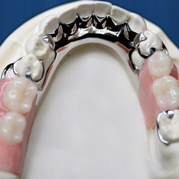 Galeri Aiman Dental (9)