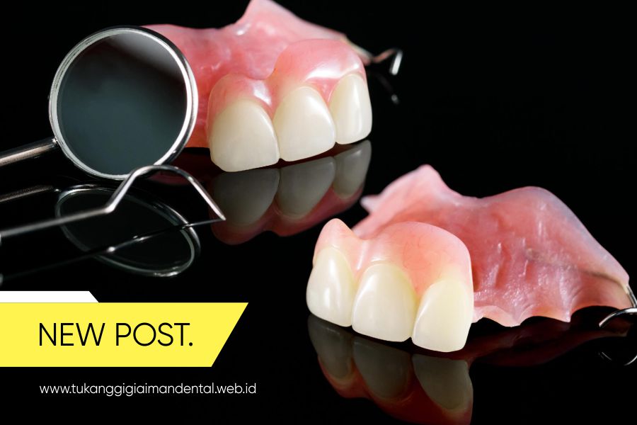 Jasa Gigi Palsu Terpercaya di Bogor